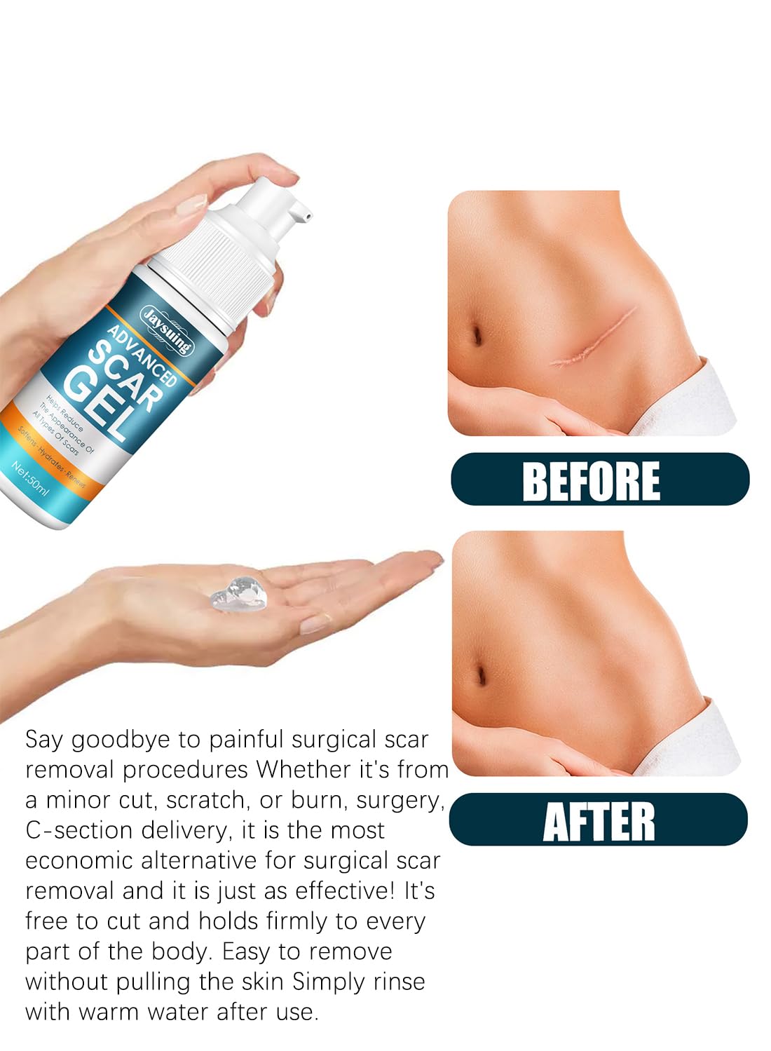Jaysuing 100% Silicone Scar Gel, Effective Quick Acting Scar Removal Cream 50g