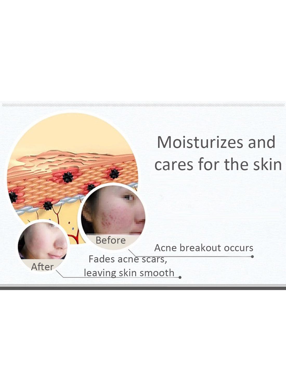 Anti-Acne Facial Serum, Gentle Face Moisturizer - 1 PC 30ml
