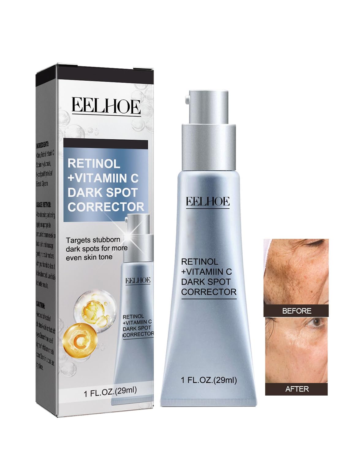 Dark Spot Remover Cream with Retinol and Vitamin C for Face and Body, 29ml