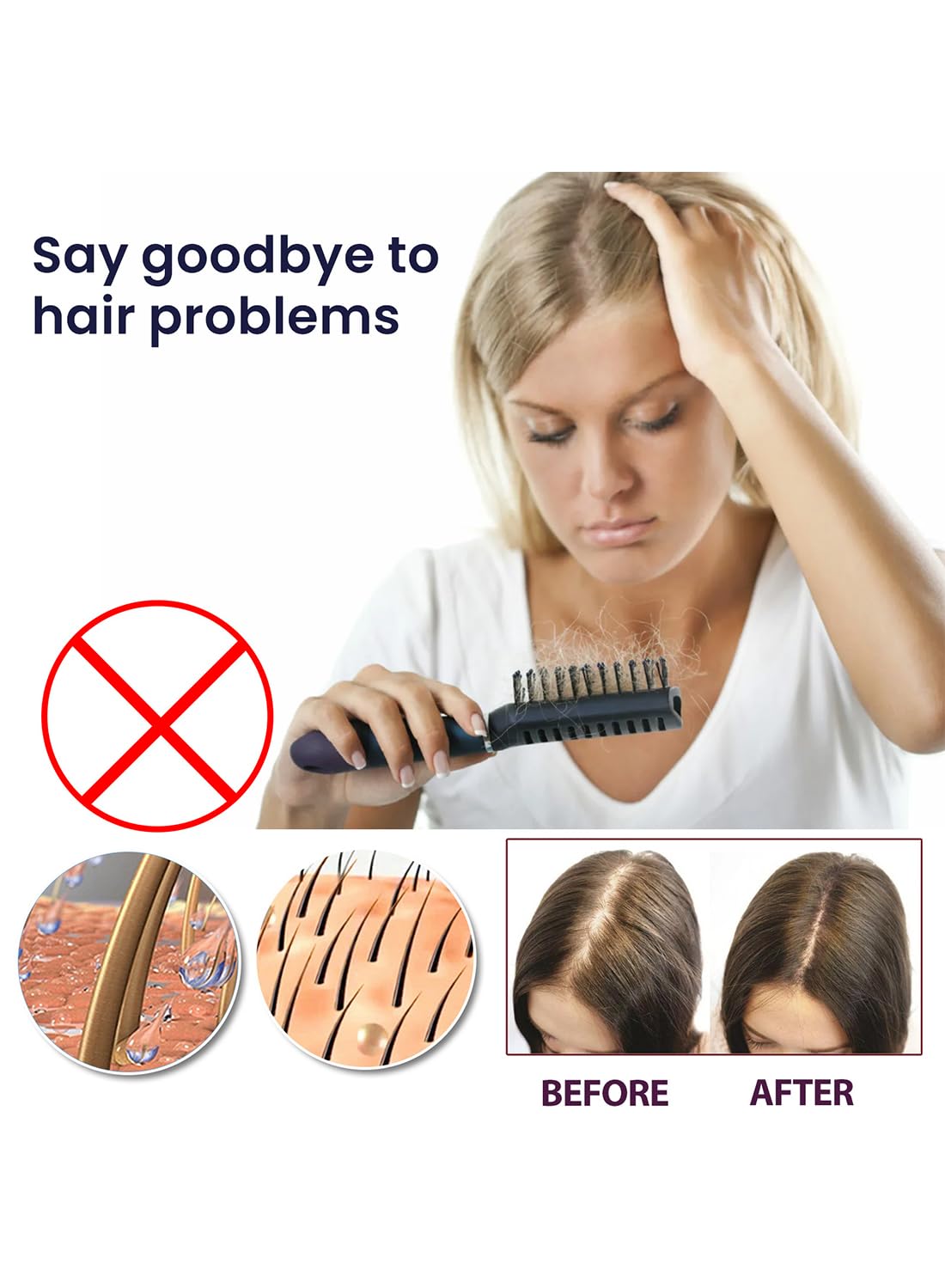 2Pcs Hair Growth Spray Set, Organic Hair Growth Serum, Hair Growth Oil, Hair Loss Treatments, Stimulate New Hair Growth, Strengthen Hair Follicles, Encourage Thicker Fuller Hair 50ml/Pcs