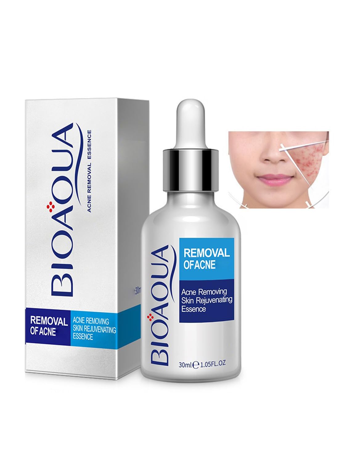 Anti-Acne Facial Serum, Gentle Face Moisturizer - 1 PC 30ml
