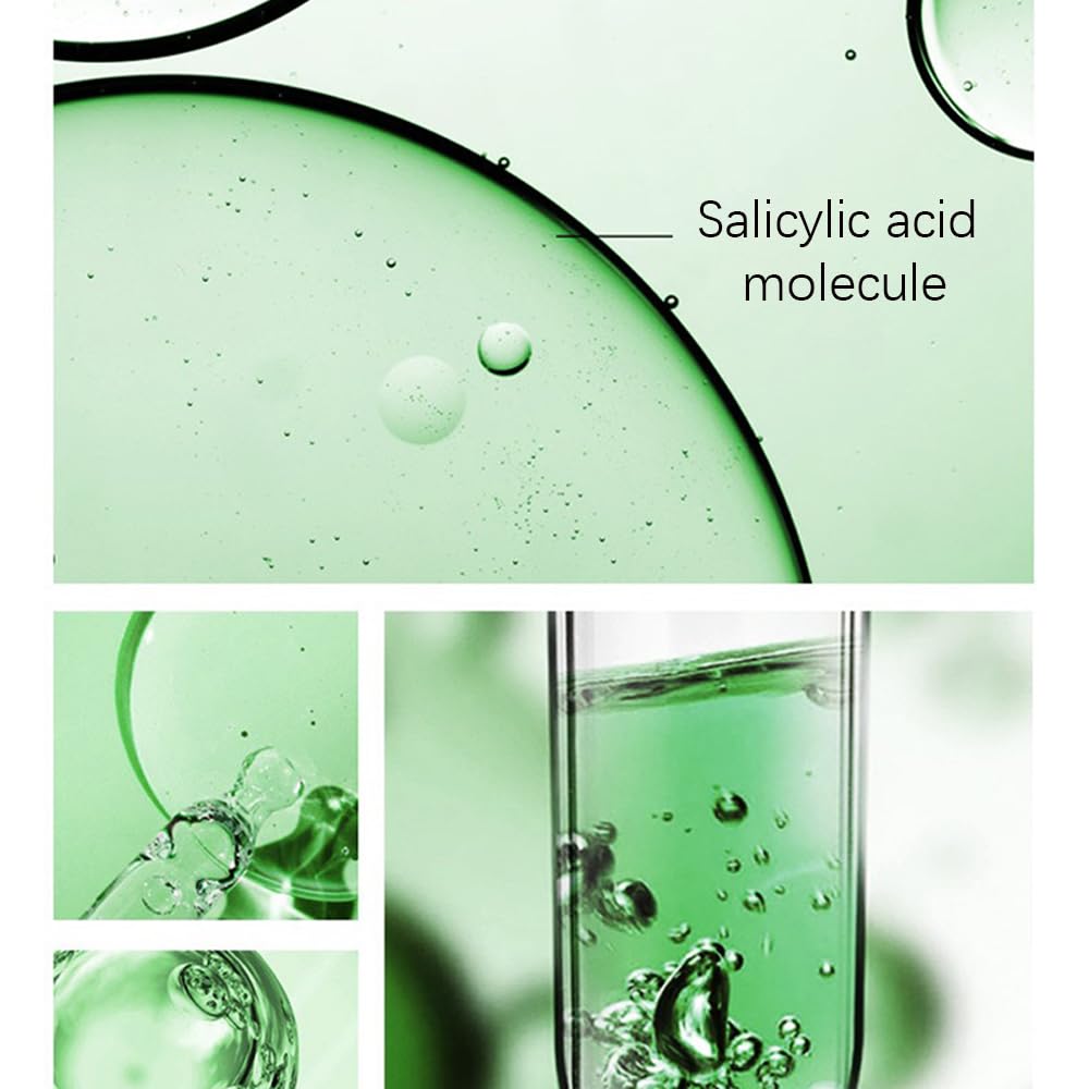 Acne Treatment for Face, Refreshing Acne Cream, Fast Active Blemish Remover