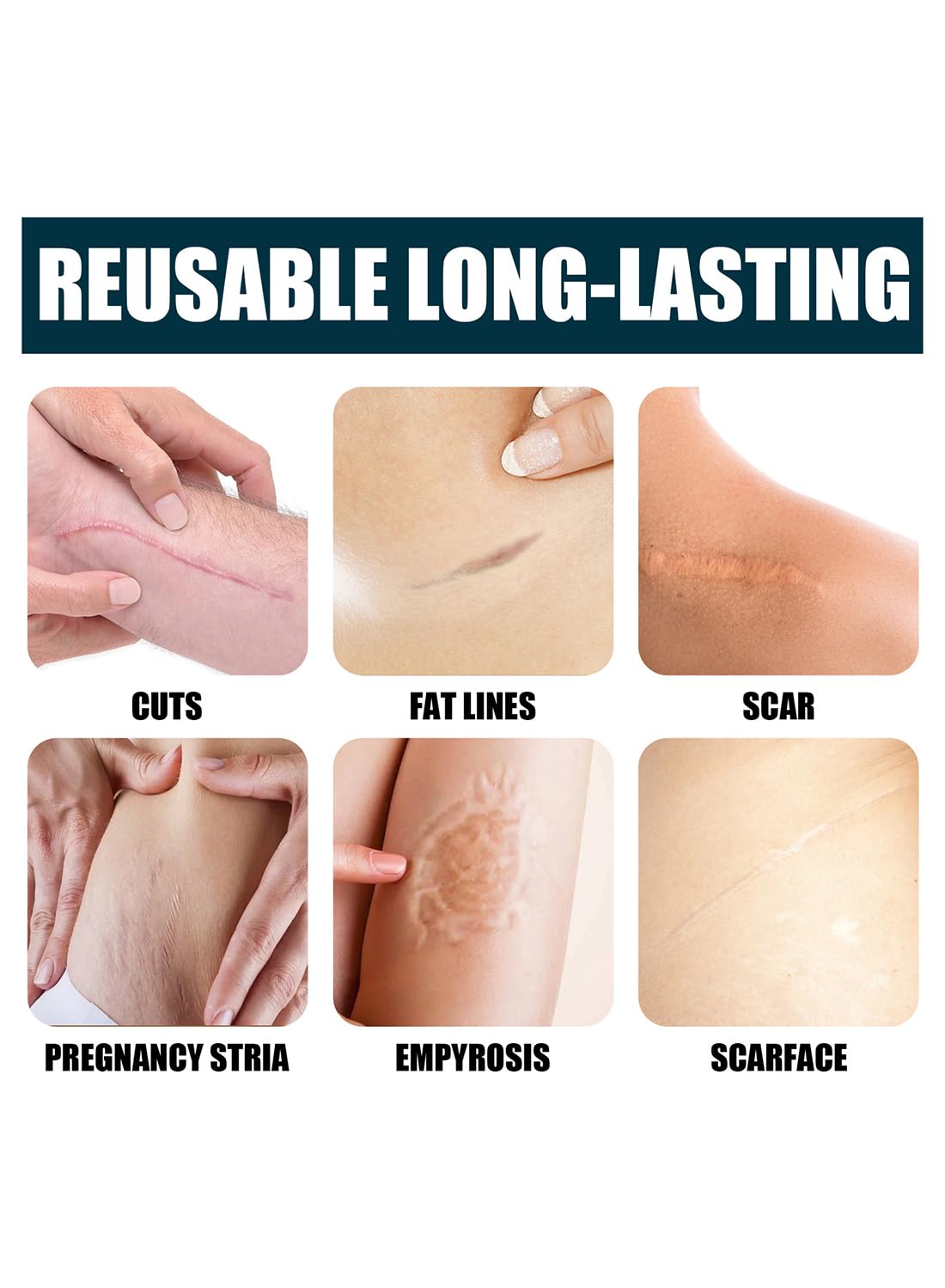 Jaysuing 100% Silicone Scar Gel, Effective Quick Acting Scar Removal Cream 50g
