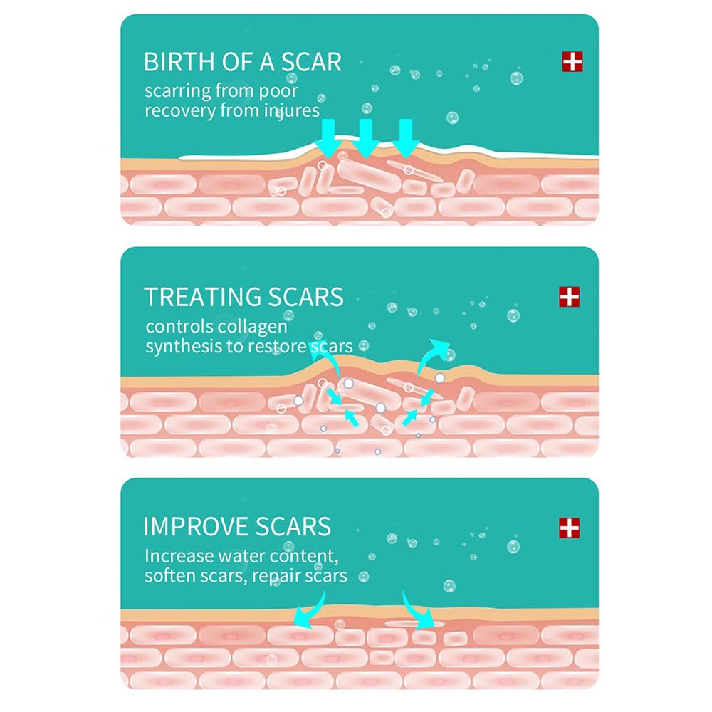 Scar Treatment Cream, Scar Removal Cream for Injury, Burns, Stretch Marks - 50g