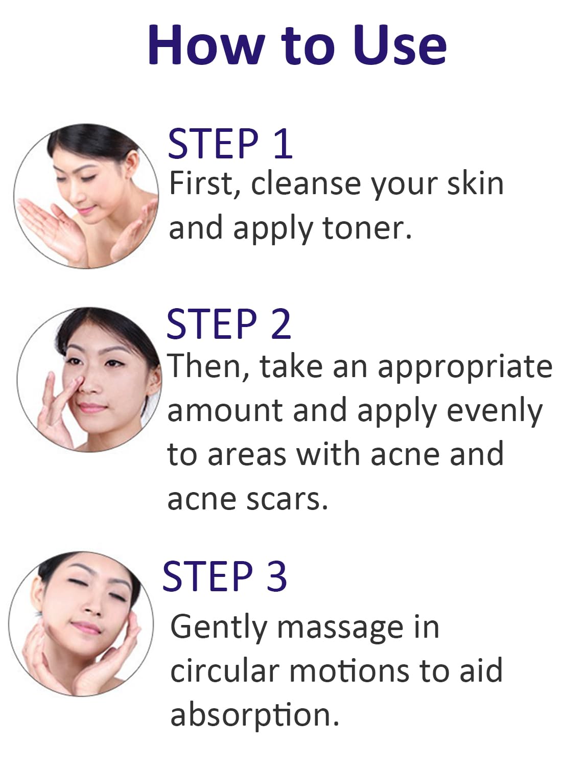 Anti-Acne Facial Treatment Cream, Gentle Face Moisturizer -  1 Pc 30g