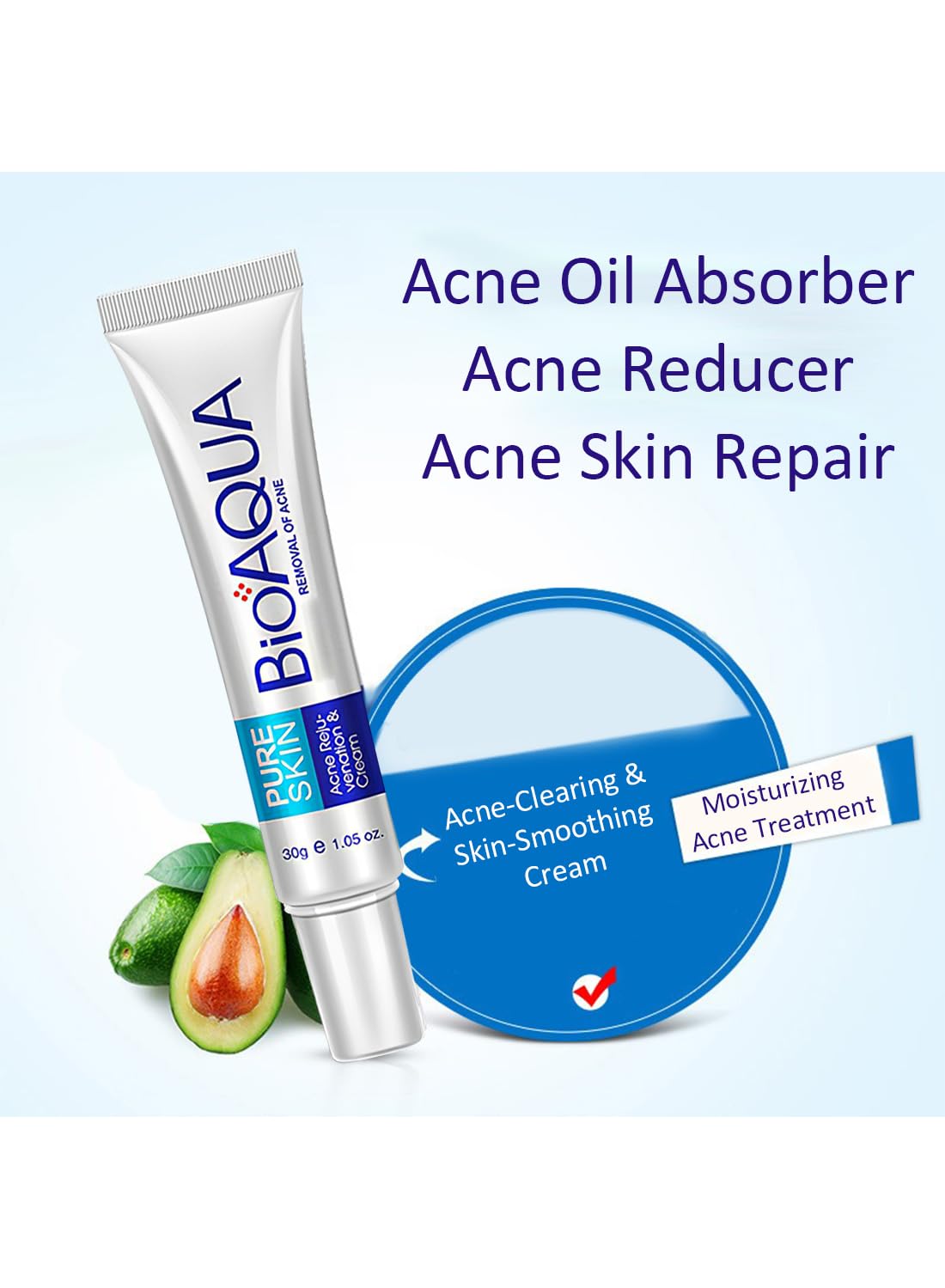 Anti-Acne Facial Treatment Cream, Gentle Face Moisturizer -  1 Pc 30g