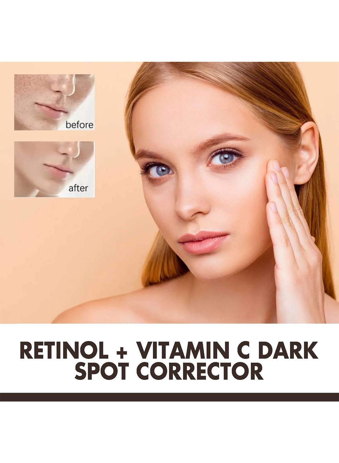 Dark Spot Remover Cream with Retinol and Vitamin C for Face and Body, 29ml