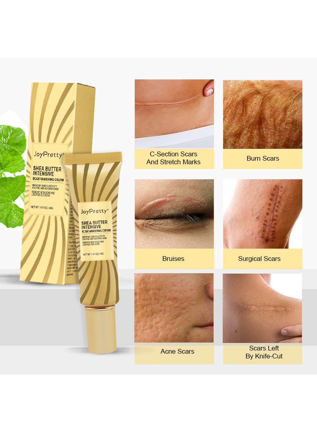 Scar Reducing Treatment, Intensive Repairing Scar Cream from Burns, Surgery 40g