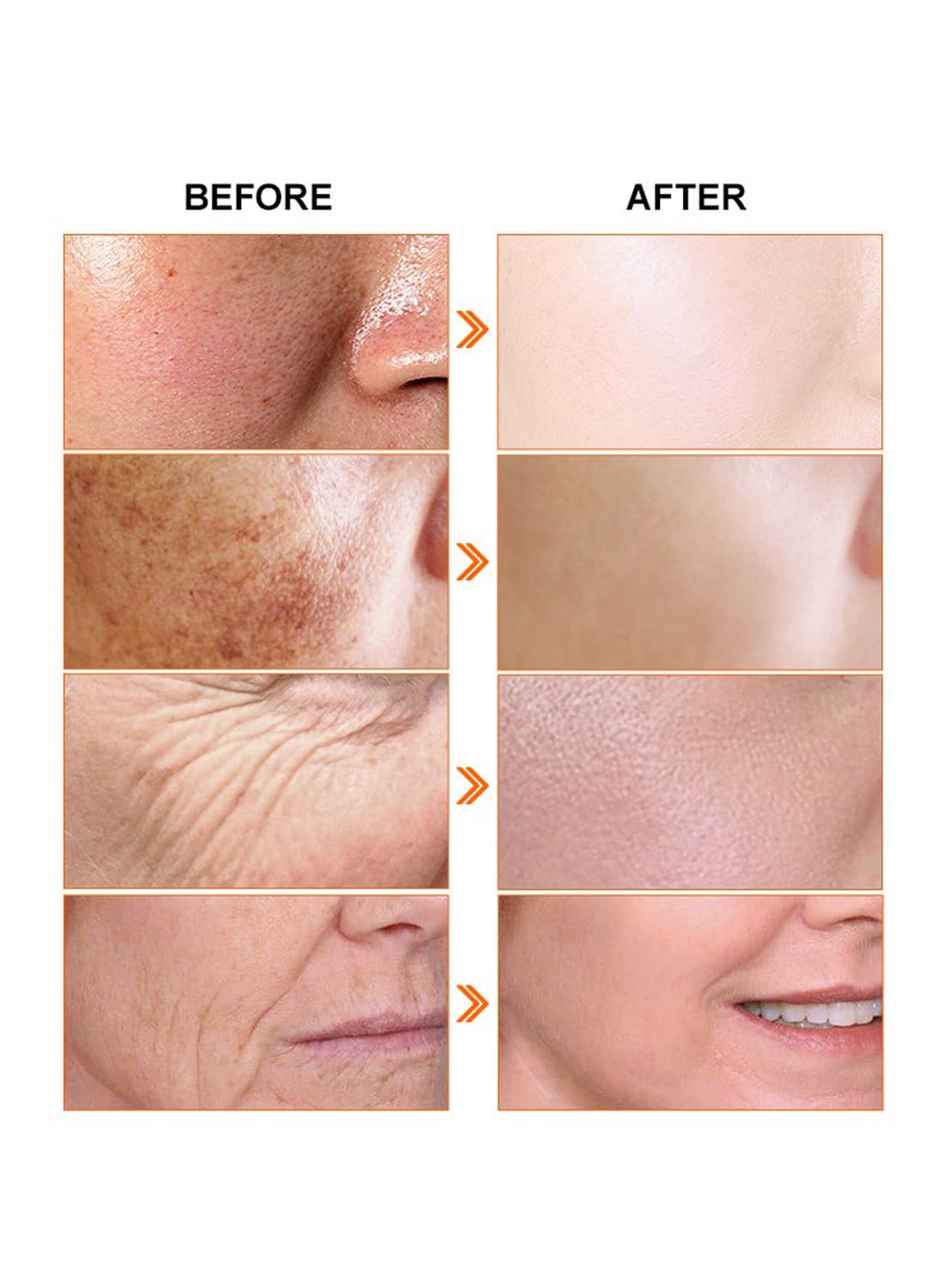 Facial Serum Kit, Anti-Aging Day & Night Face Treatment Essence Set