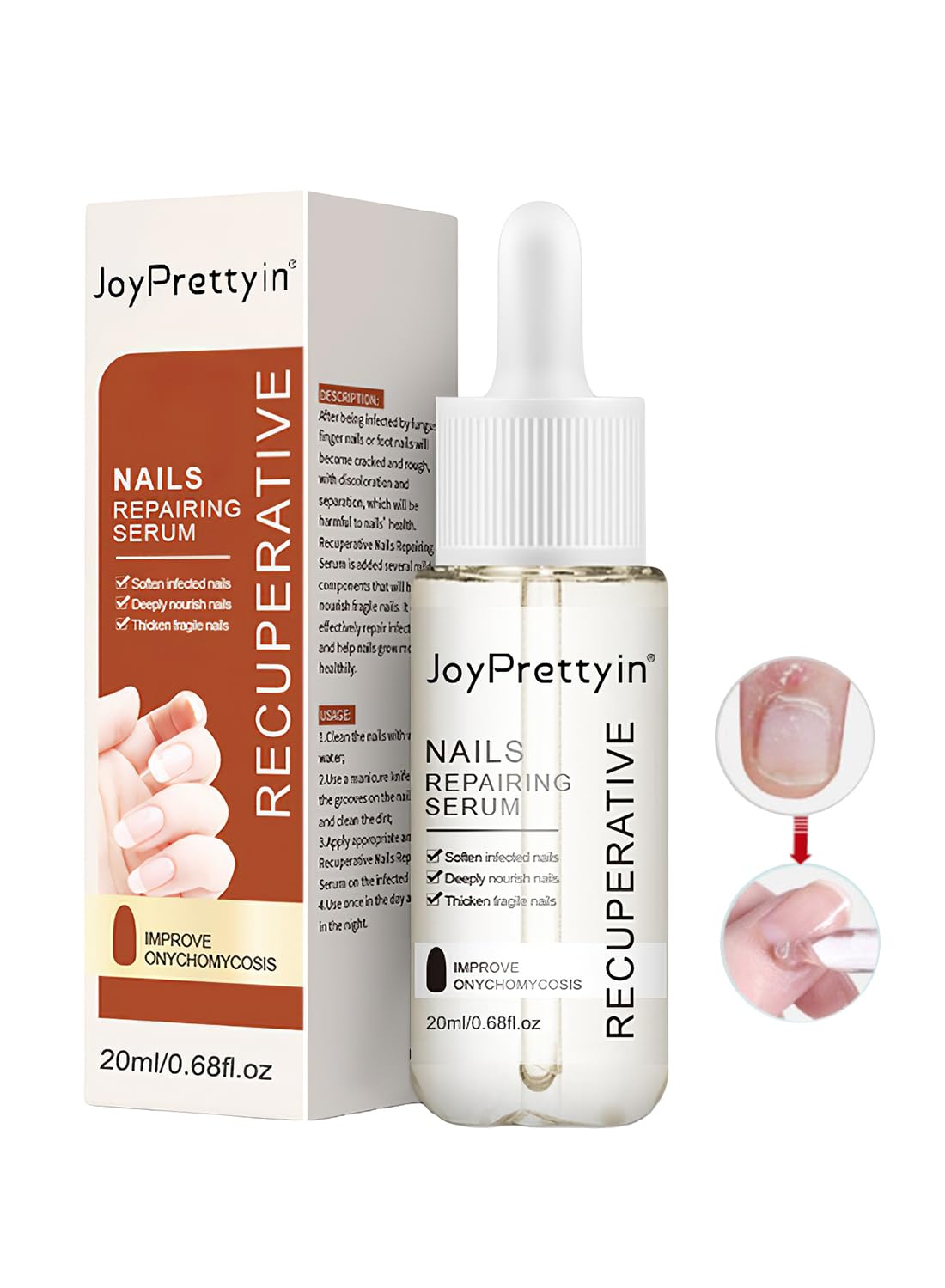 Nail Repair Cream, Nail Grooming Gel for Onychomycosis and Damaged Nails 20 ml