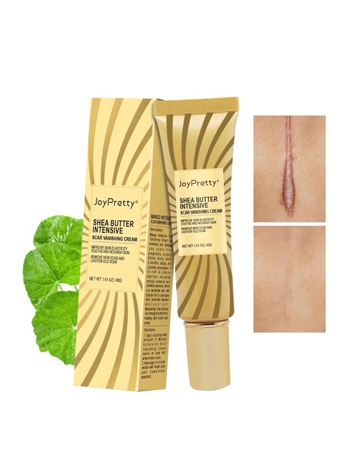 Scar Reducing Treatment, Intensive Repairing Scar Cream from Burns, Surgery 40g