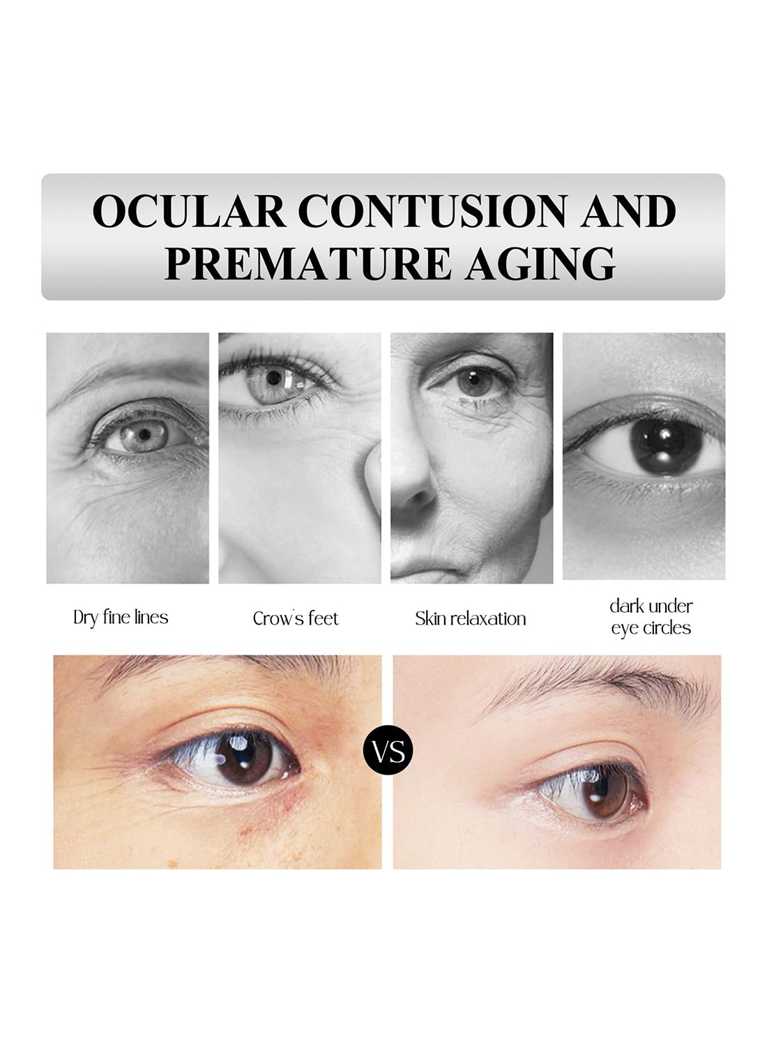 Eye Treatment Serum with a Roller, Anti-Wrinkle Nourishing Eye Essence, 20ml