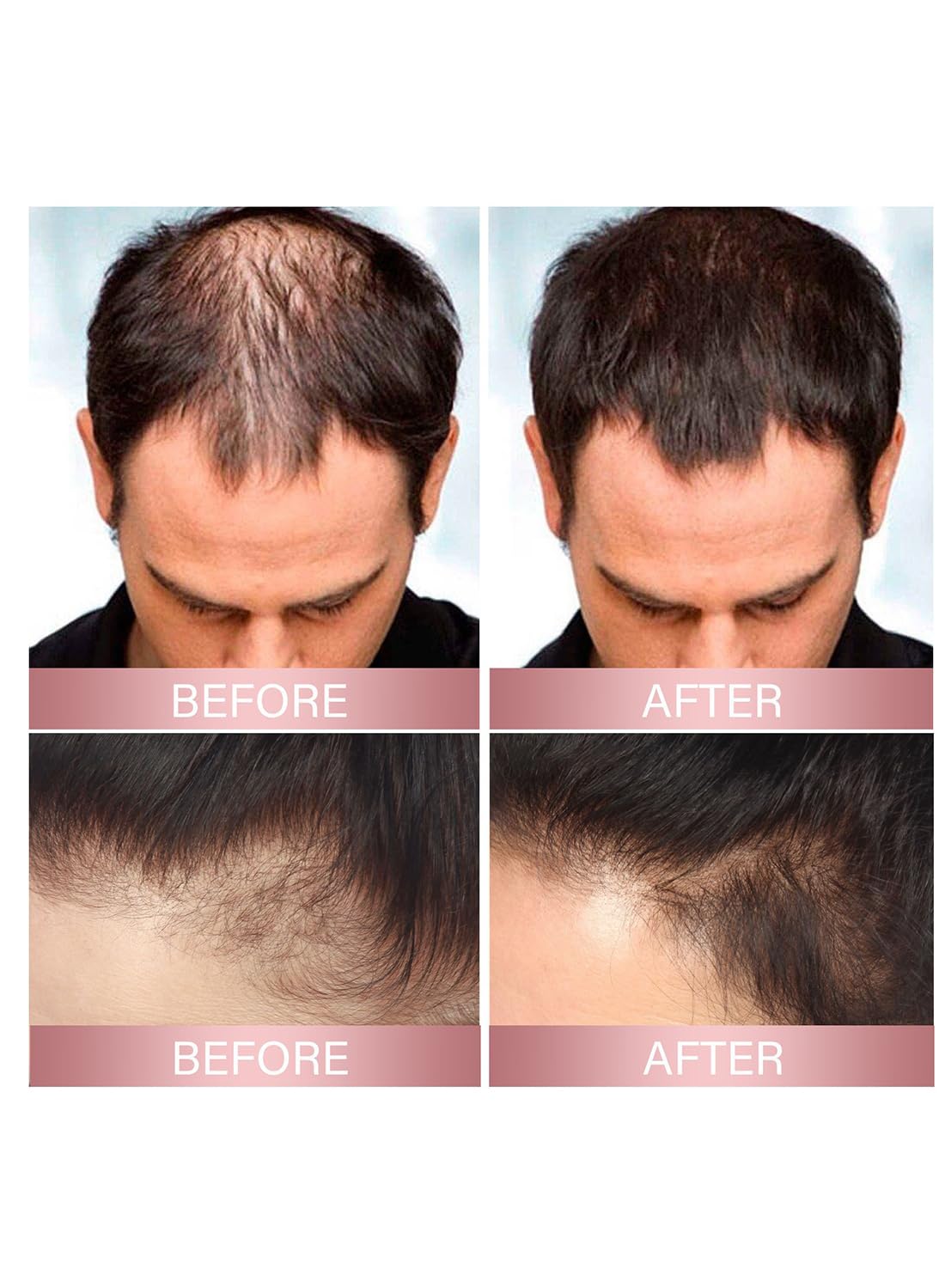 L&Wen Hair Helper Spray, Moisturizing Strengthening Hair Growth Spray for Thinning Hair, Anti Hair Loss Volumizing Rice Nutri Spray with Ginger Root Aloe Vera, Restore Dry Damaged Hair 50ml