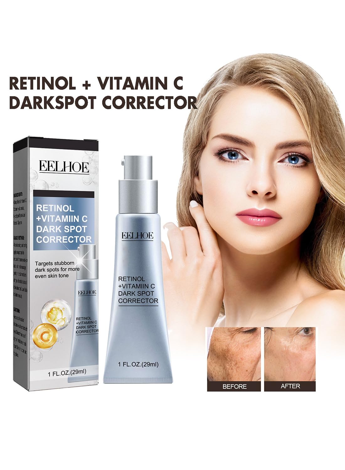 Dark Spot Remover Cream with Retinol and Vitamin C for Face and Body, 29ml