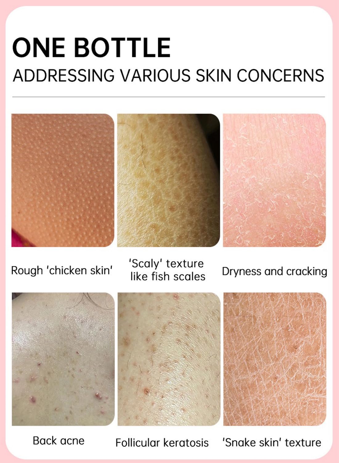 Repair Cream, Exfoliating Treatment for Dry and Rough Skin with Urea & VC