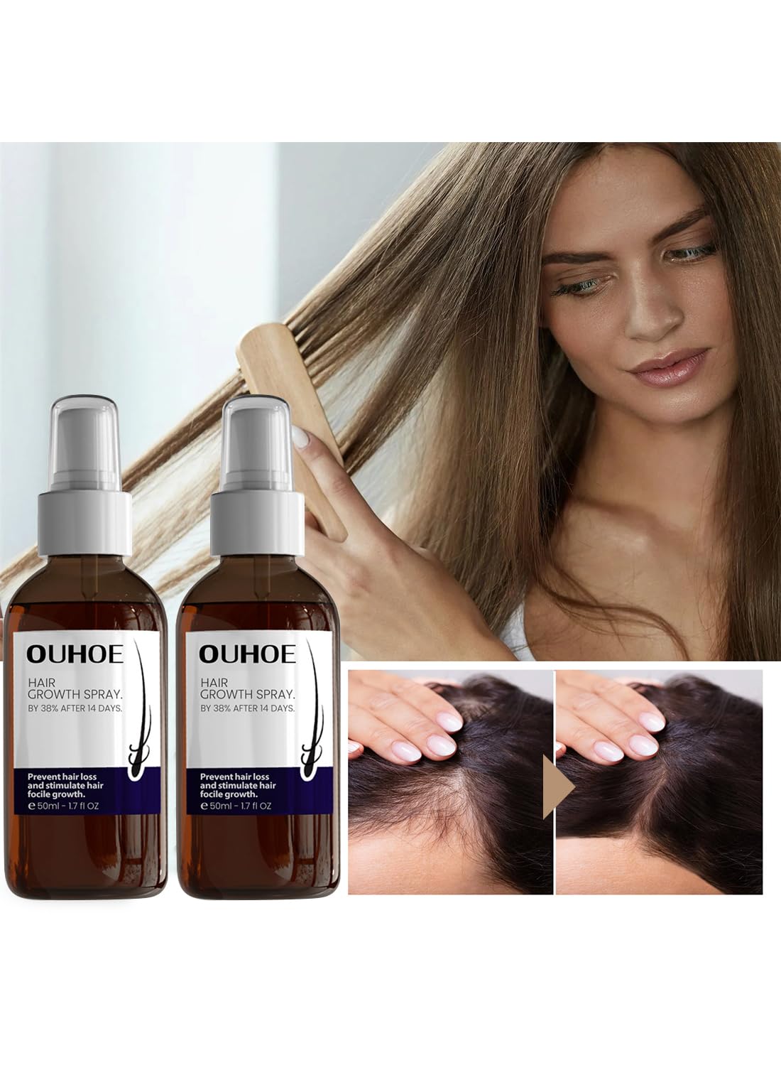 2Pcs Hair Growth Spray Set, Organic Hair Growth Serum, Hair Growth Oil, Hair Loss Treatments, Stimulate New Hair Growth, Strengthen Hair Follicles, Encourage Thicker Fuller Hair 50ml/Pcs