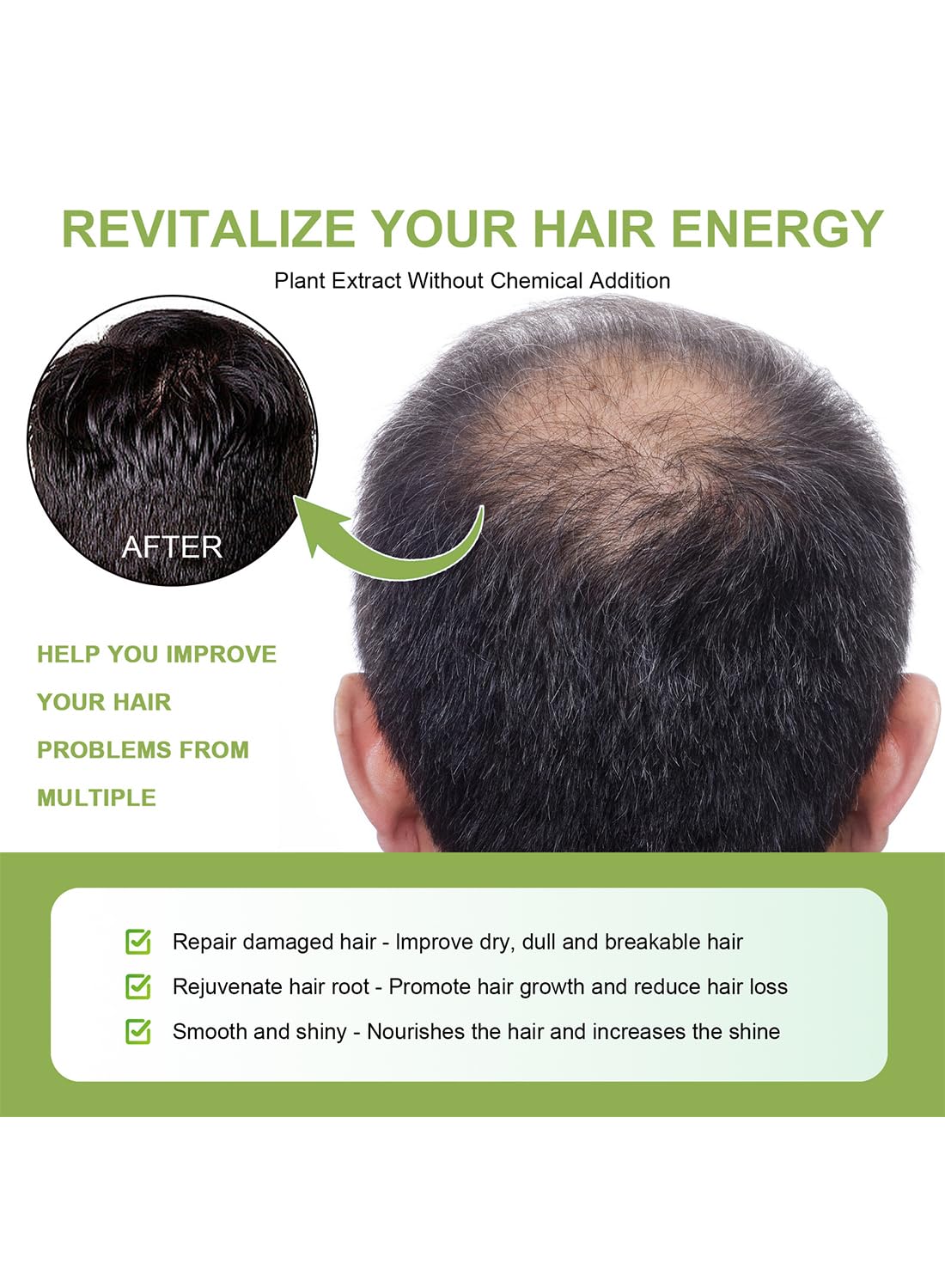 2Pcs Rosemary Mint Scalp & Hair Strengthening Oil Spray Set Hair Growth Oil to Help Stimulate New Hair Growth and Strengthen Hair Follicles and Encourage Thicker Fuller Hair 60ml/Pcs