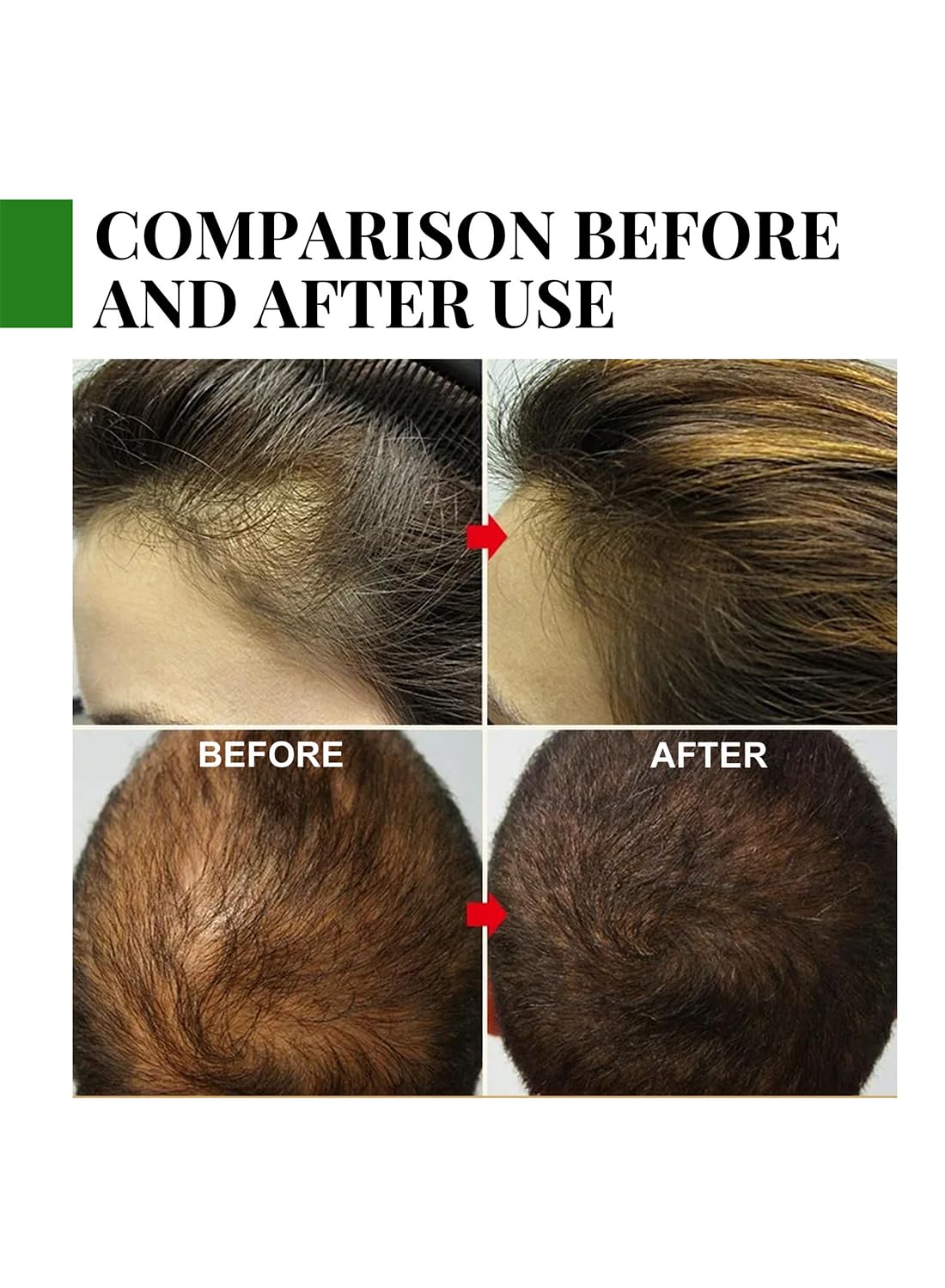 Rosemary Essential Oil, Hair Strengthening Oil, with Pure and Natural Formula, Promote Hair Growth, Nourish the Scalp, Repair Hair 30ml