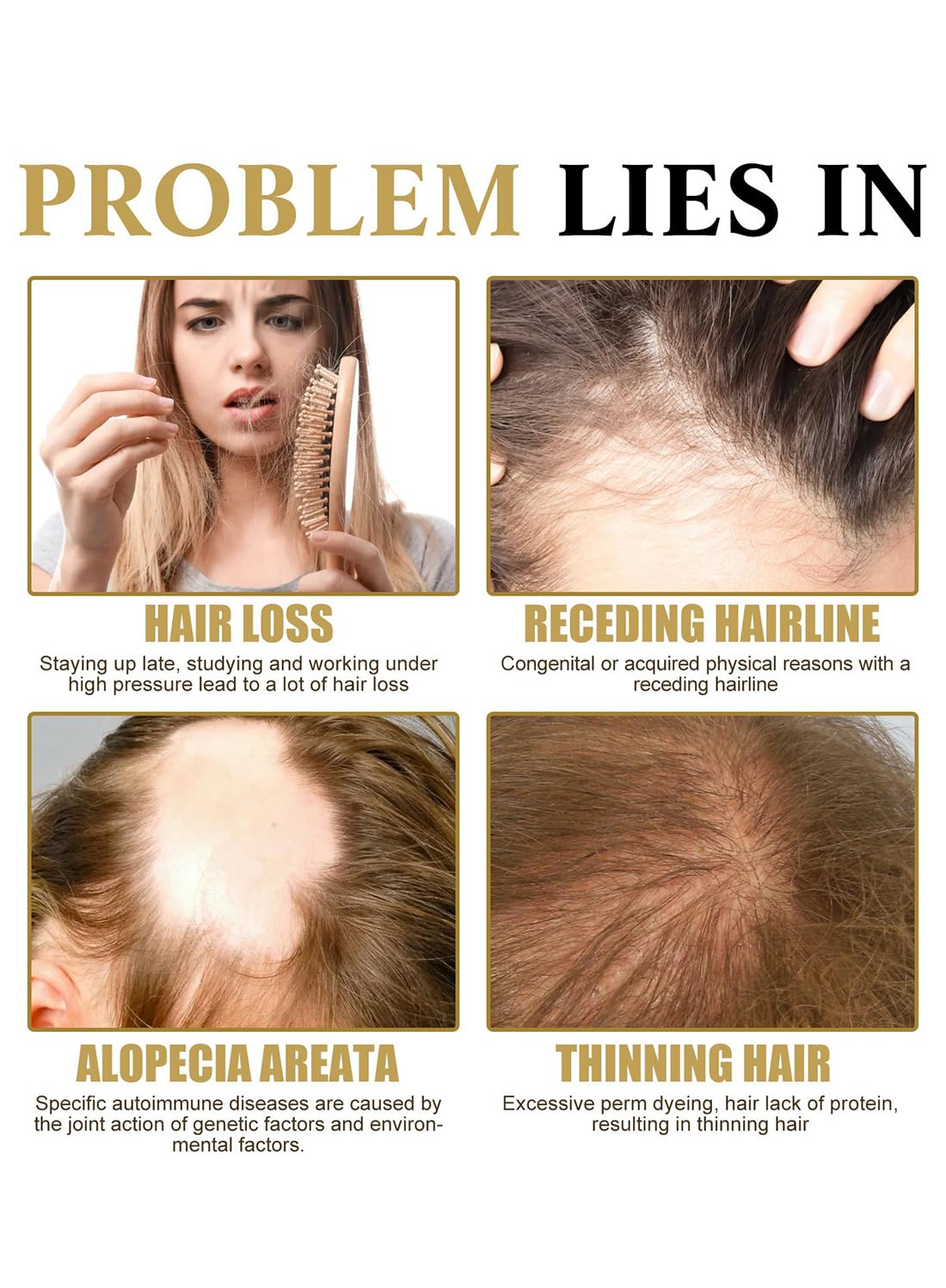 Hair Loss Treatment for Hair Growth, Anti Hair Loss Roll On Massage Hair Boost Essence, Darkens & Strengthens & Promotes Hair Circulation, Reduces Hair Loss, Restores Thin Hair 20ml