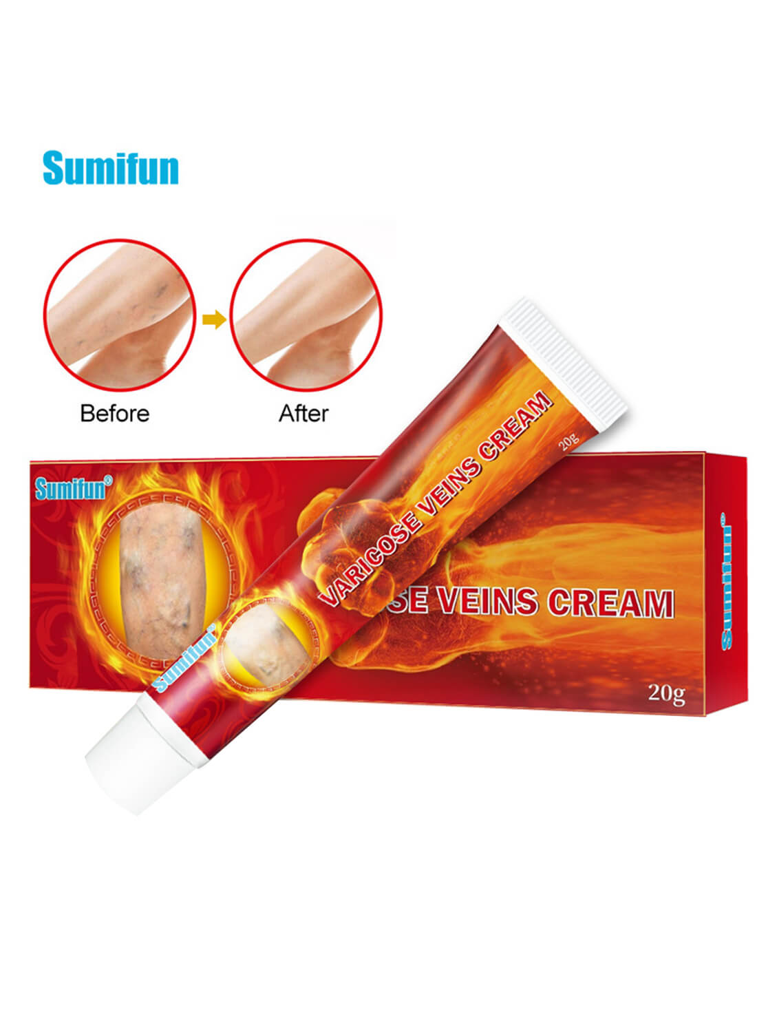 Sumifun Varicose Veins Treatment Cream