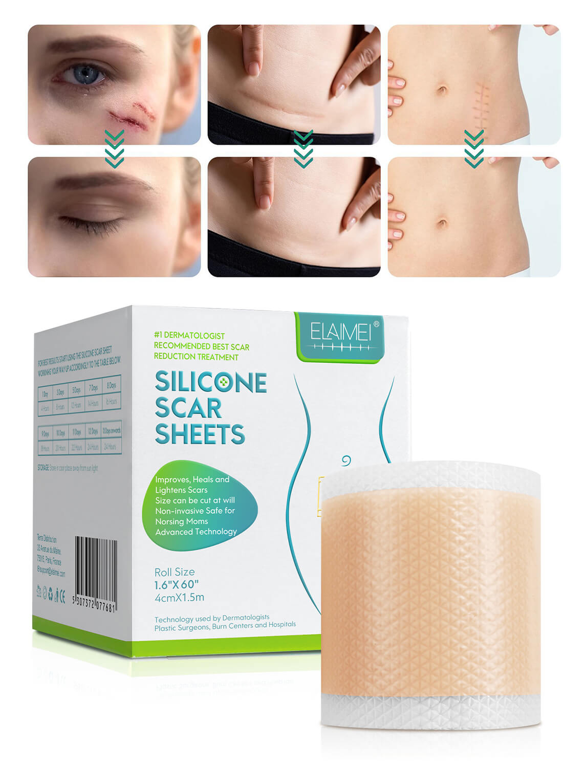 ELAIMEI Silicone Scar Sheets Skin Care 4cm*1.5m