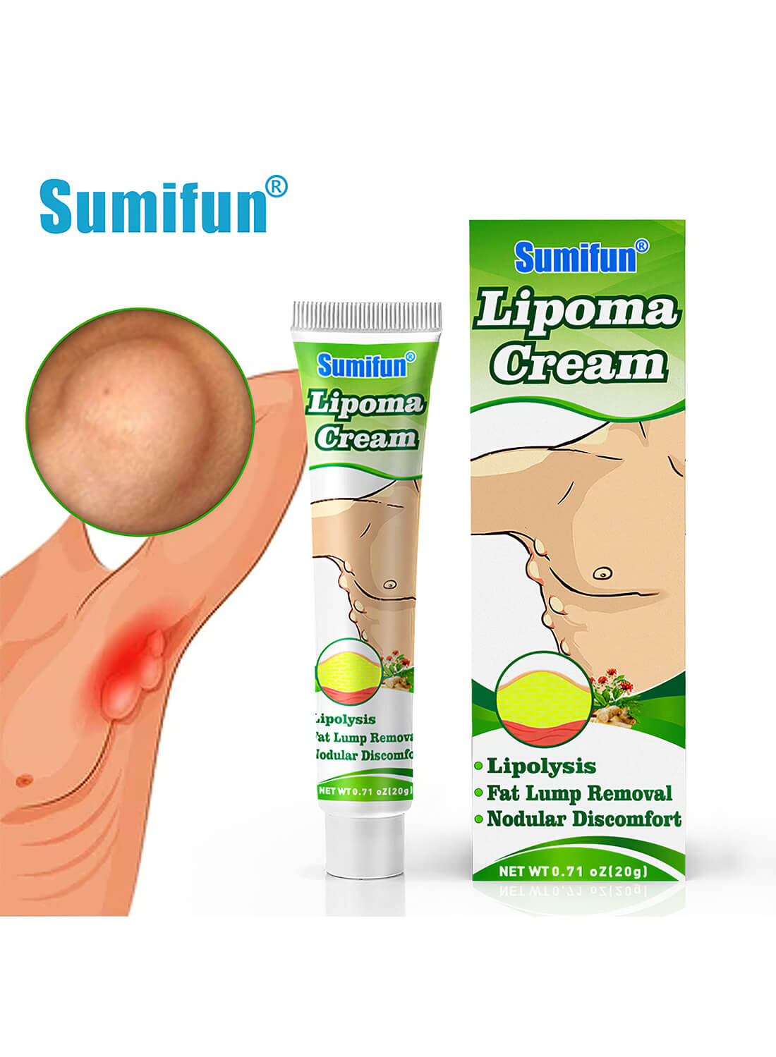 Sumifun Lipoma Removal Cream 20g