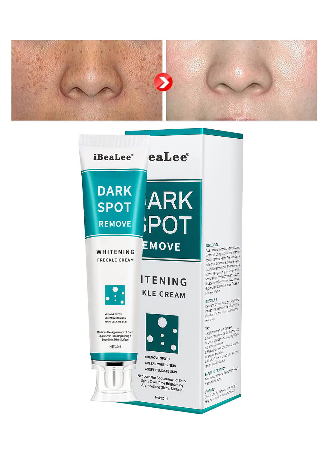 Dark Spot Remover for Face Sun Spots Age Spots Chloasma 20ml