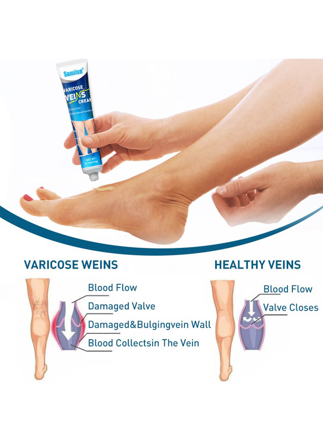 Varicose Veins Cream, Natural Varicose Veins Treatment for Legs 20g