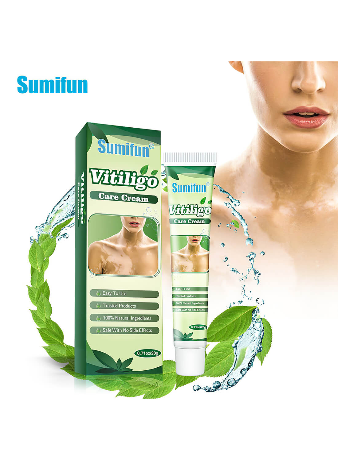 Vitiligo Care Cream, Vitiligo Cream, Vitiligo Treatment 20g